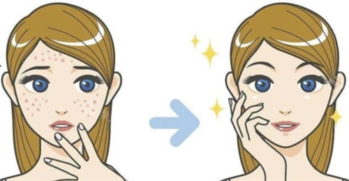 Animated before and after comparison displaying acne treatment results with clearer skin, reduced blemishes, and smoother texture.