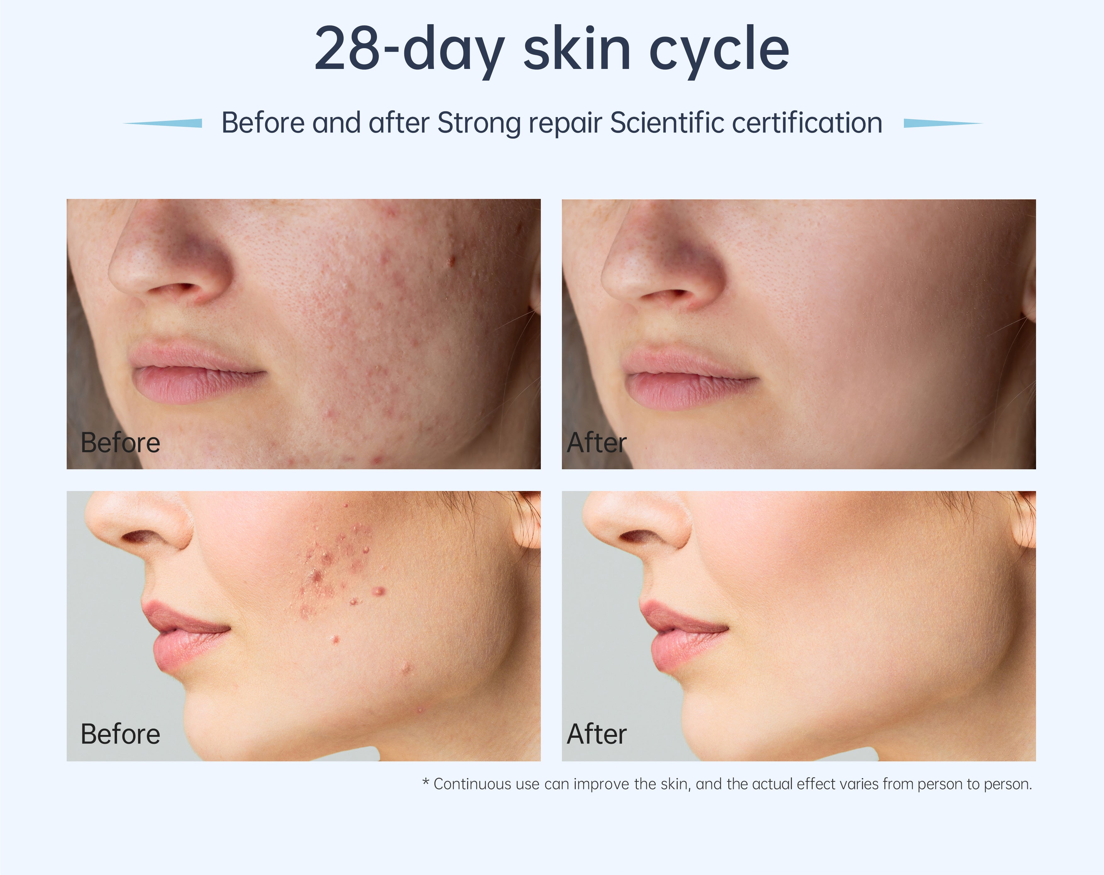 Dr. Pen A11 Ultima Pro Derma Microneedling Pen