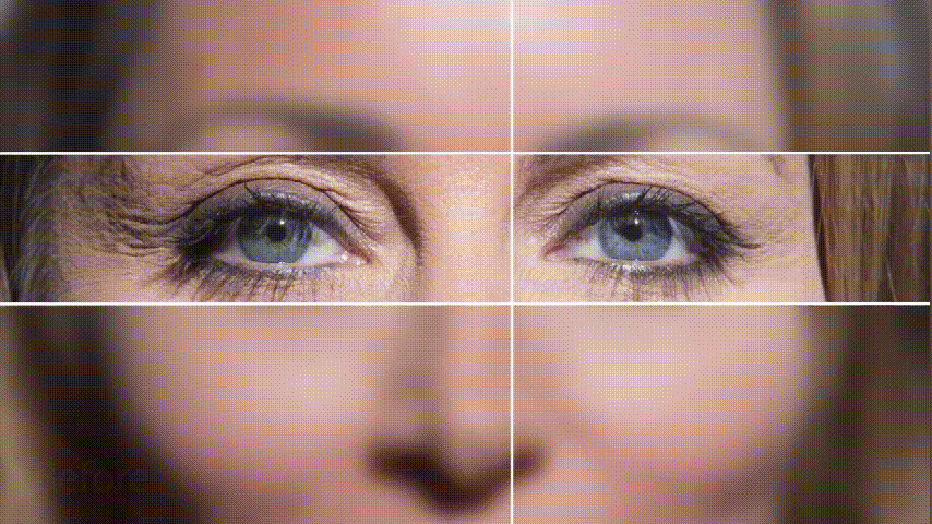 GIF of bio PEN Q2 before and after eye wrinkle reduction,featuring men and women with smoother skin using microneedling and LED technology.