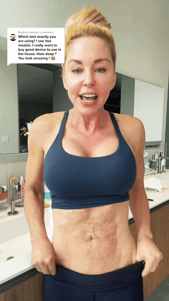 Engaging GIF by Jessica Barn showcasing Dr. Pen M8S,transforming stretch marks post-pregnancy with visible results after 4 sessions.