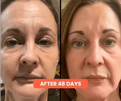 Dr Pen Ultima A10 Microneedling Pen with FREE 12 Replacement Cartridges