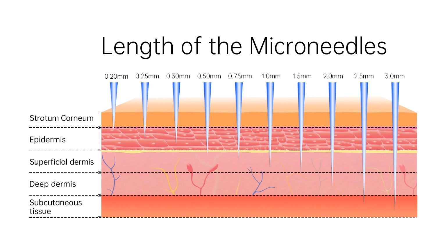 Cross-section illustration showing microneedling needles of different lengths penetrating the skin at various depths to target fine lines,acne scars,and hair loss,highlighting the customizable settings of the Dr. Pen M8S