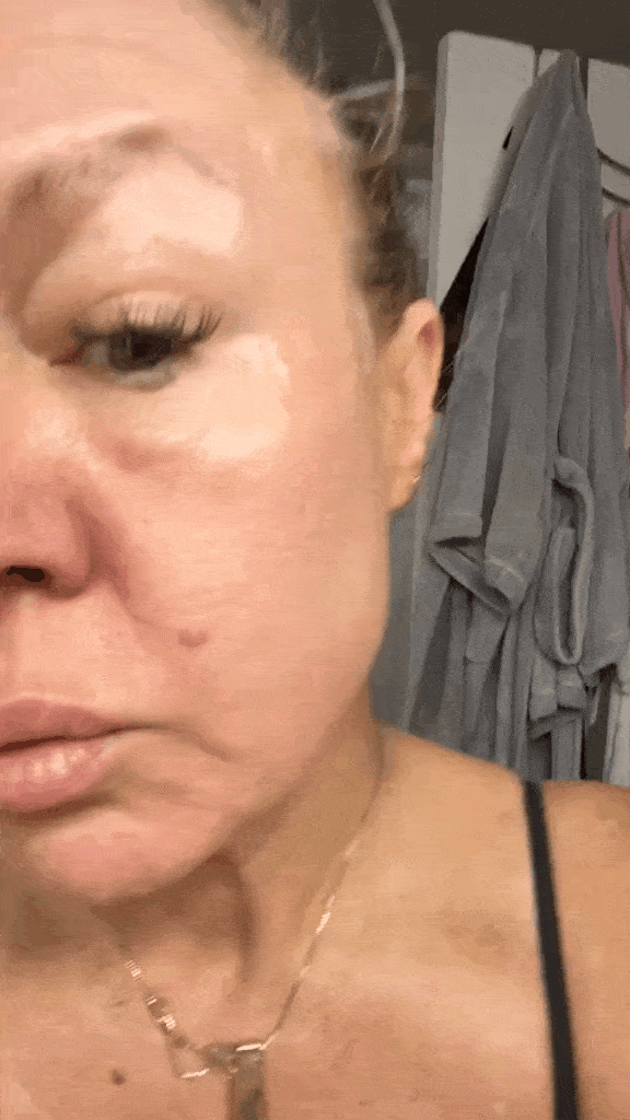 Animated GIF illustrating anti-aging treatment effects with diminished wrinkles, firmer skin, and youthful glow.