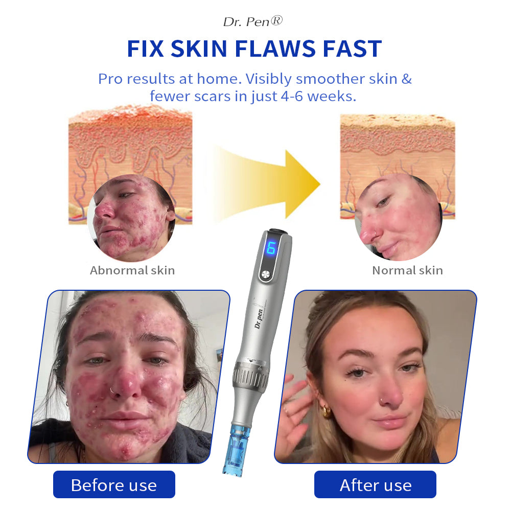 Dr. Pen M8S Microneedling Pen with FREE 20 Replacement Cartridges