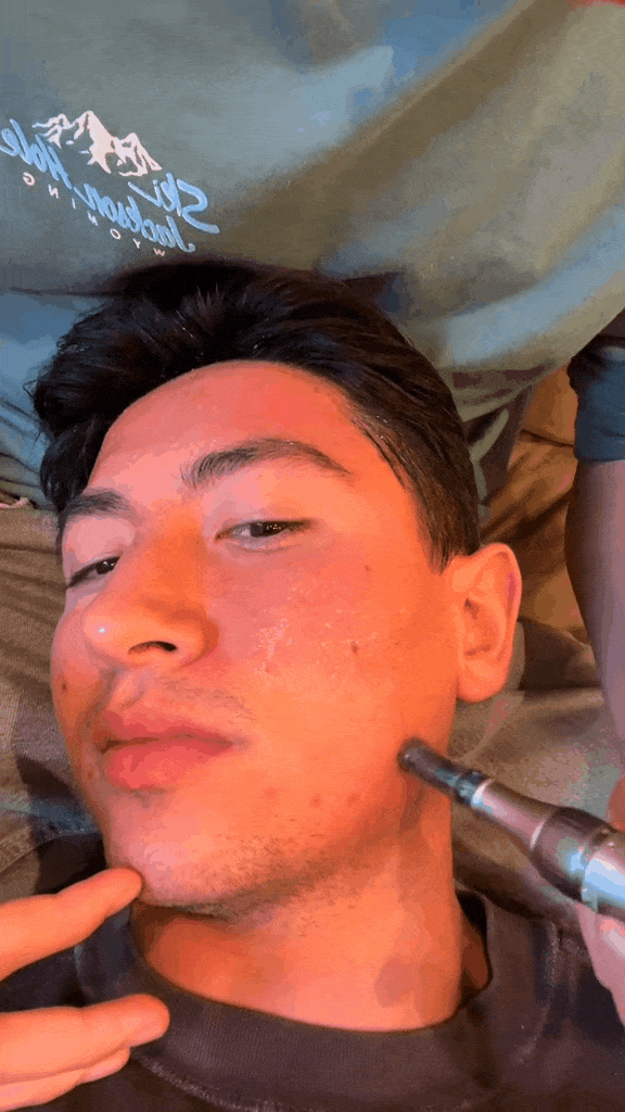 Salon professional using the wireless Dr. Pen M8s microneedling device on a client’s face to reduce acne scars and redness during a quick and comfortable facial treatment.