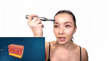 Dr. Pen M8S Microneedling Pen with FREE 20 Replacement Cartridges