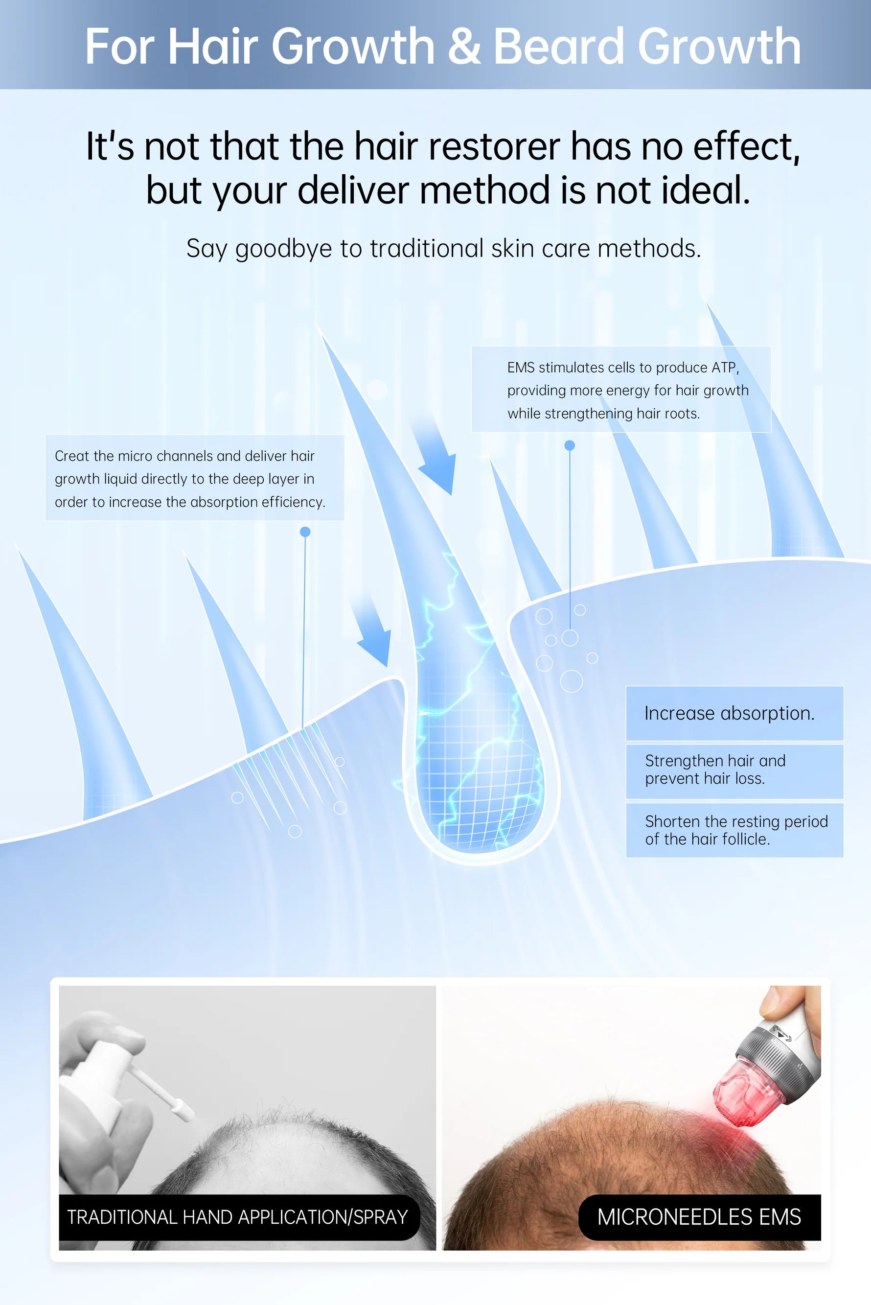 bio PEN Q2 25 pole pulse EMS electroporation,stimulating cells with microcurrent energy for skin and hair rejuvenation.